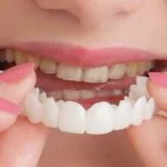 روکش دندان دندانپزشکی در مشهد پارمیس