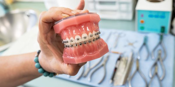 ارتودنسی چیست و چه مزایایی برای دهان و فک دارد؟