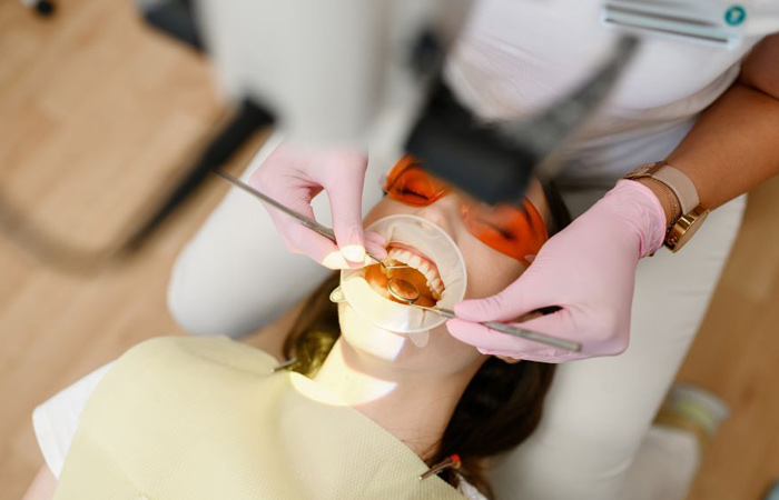 جرمگیری ایمپلنت دندان چیست؟ بررسی نحوه انجام و مزایای آن