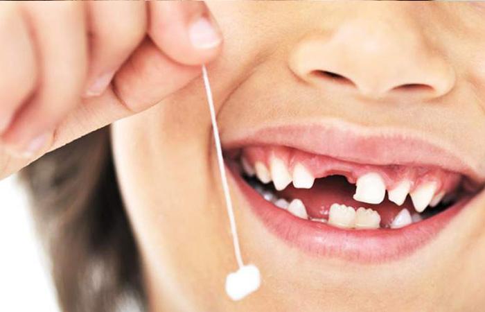 علائم افتادن دندان شیری کودک چیست؟