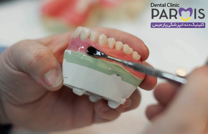 دکتر پروتز دندان در مشهد