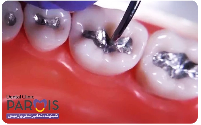 پرکردگی آمالگام