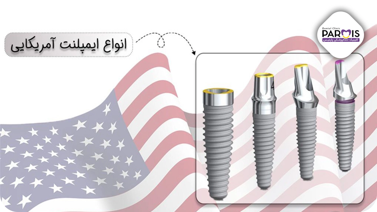 انواع ایمپلنت آمریکایی دندان