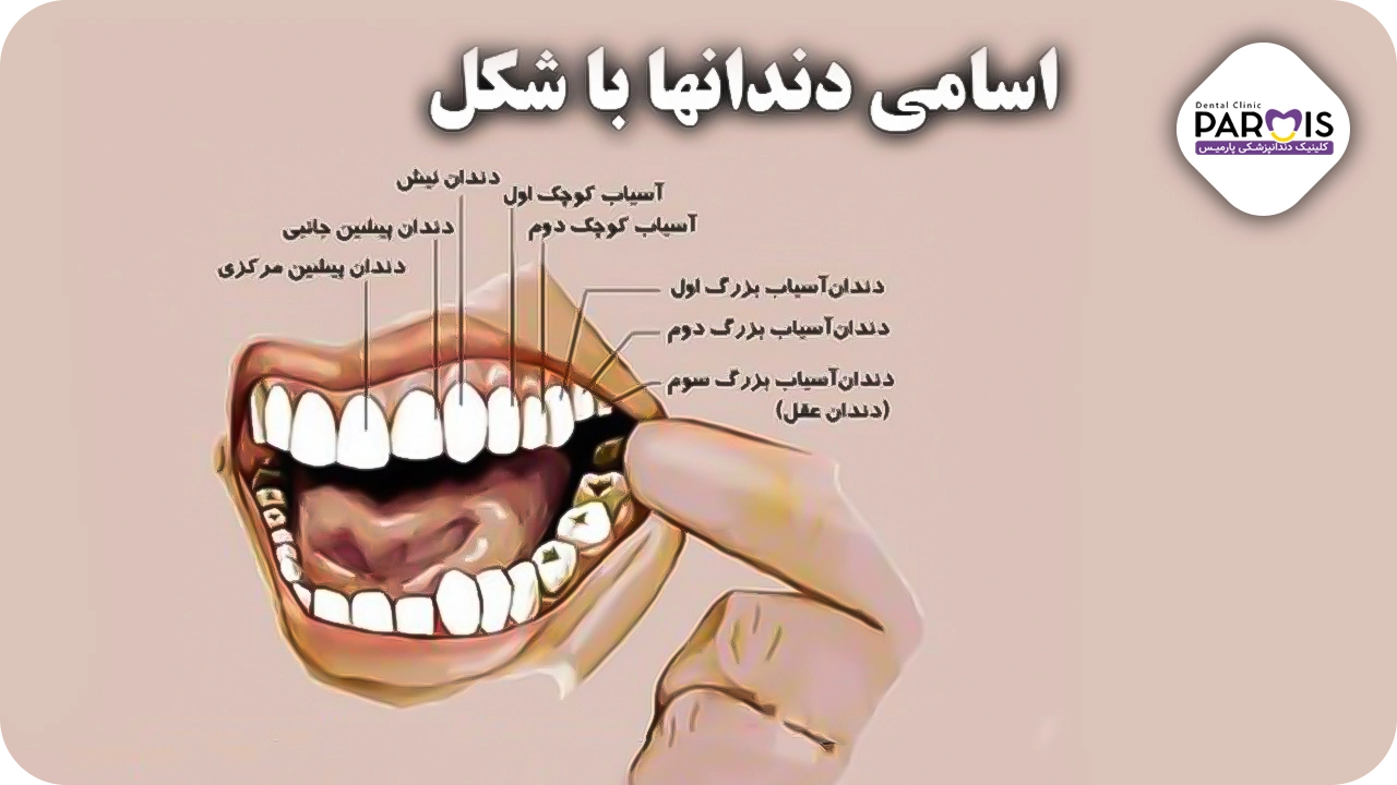 نام گزاری دندان