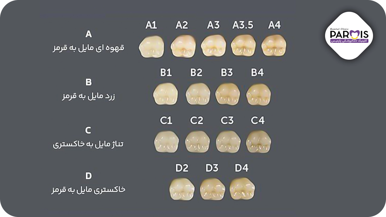 انواع رنگ کامپوزیت دندان