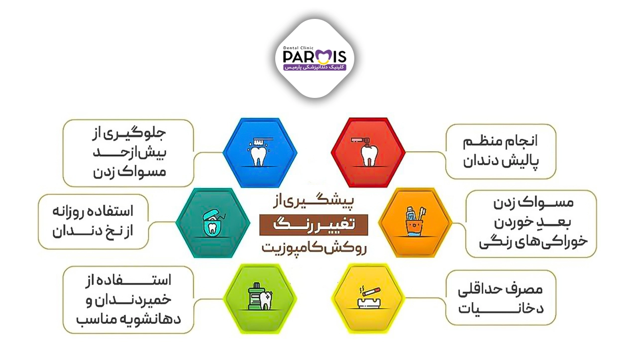 پیشگیری از تغییر رنگ کامپوزیت