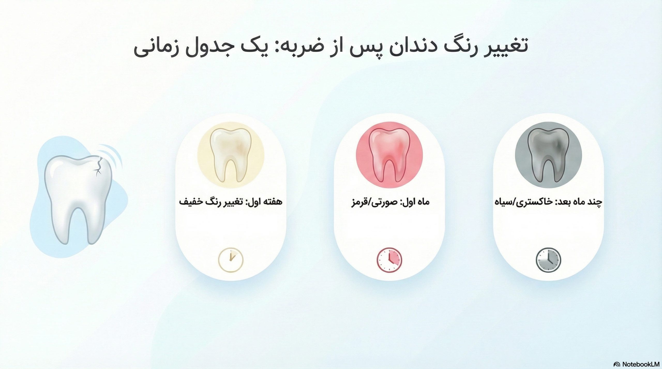 تغییر رنگ دندان کودک پس از ضربه